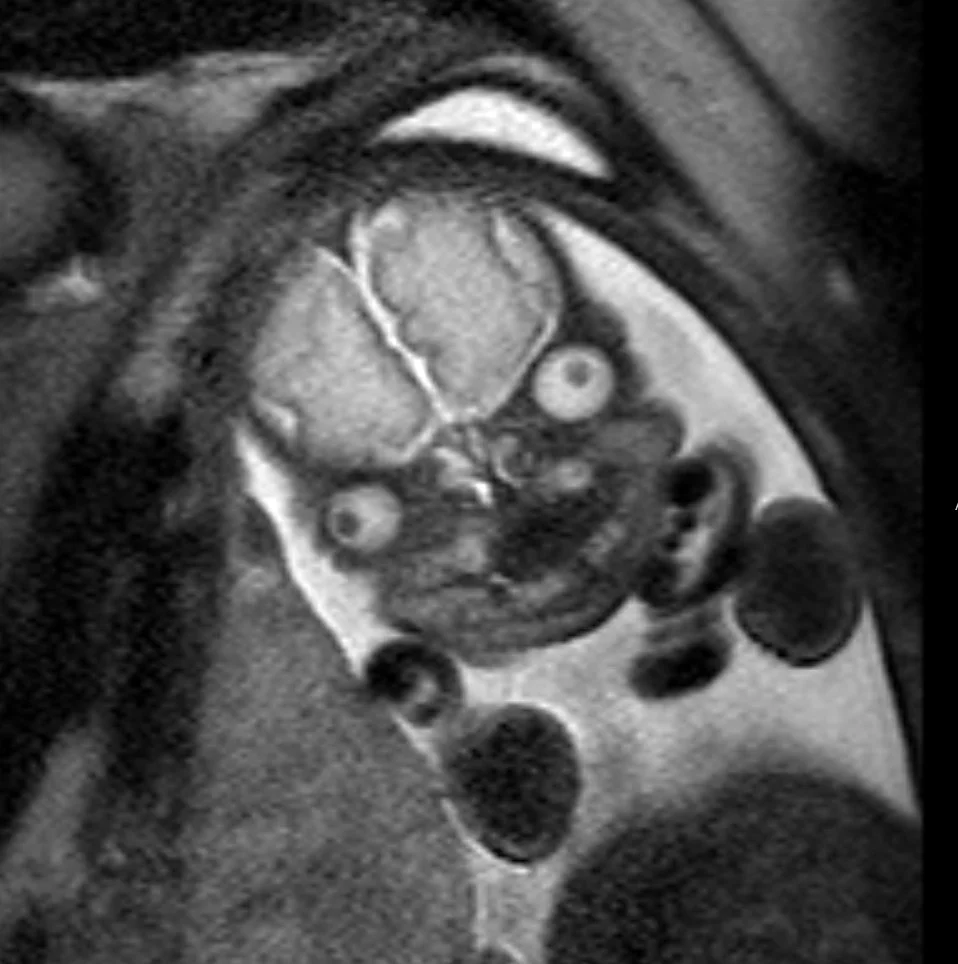 FRCR 2B short case - Full lossless DICOM radiograph for exam practice