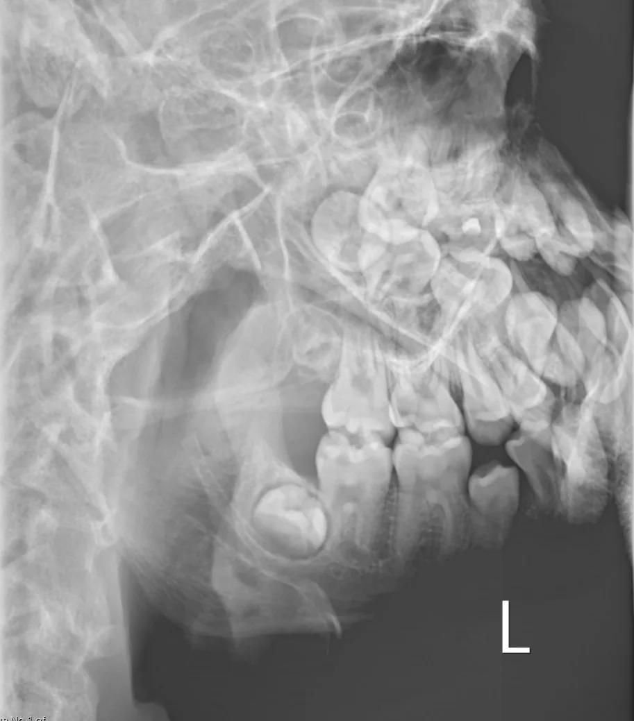 FRCR 2B short case packet - RCR compliant display quality