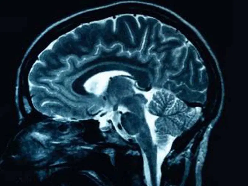 FRCR 2B long case - Diagnostic quality CT scan for radiology training