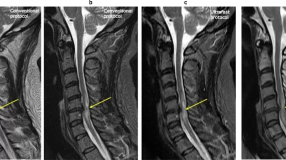 FRCR 2B rapid reporting - Authentic radiograph with expert annotations