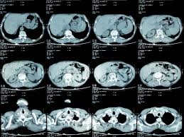 FRCR 2B practice - Cross-sectional imaging at workstation quality