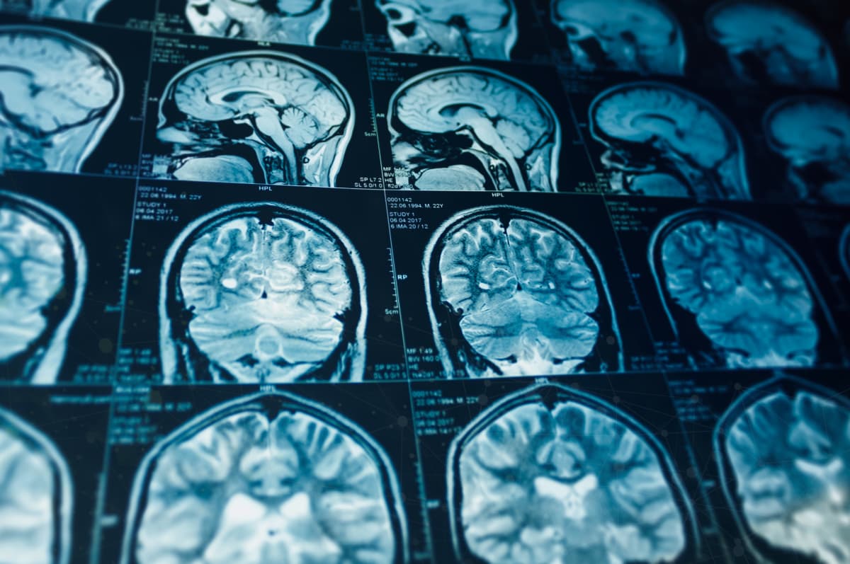 FRCR 2B MRI case - Full lossless DICOM following RCR guidelines