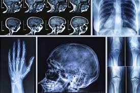 FRCR 2B X-ray case - Non-AI authentic radiology content