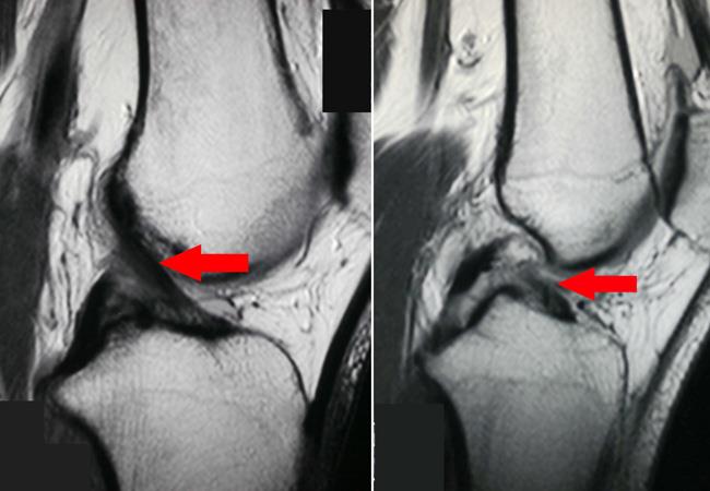 FRCR 2B reporting practice - Expert-created radiology case