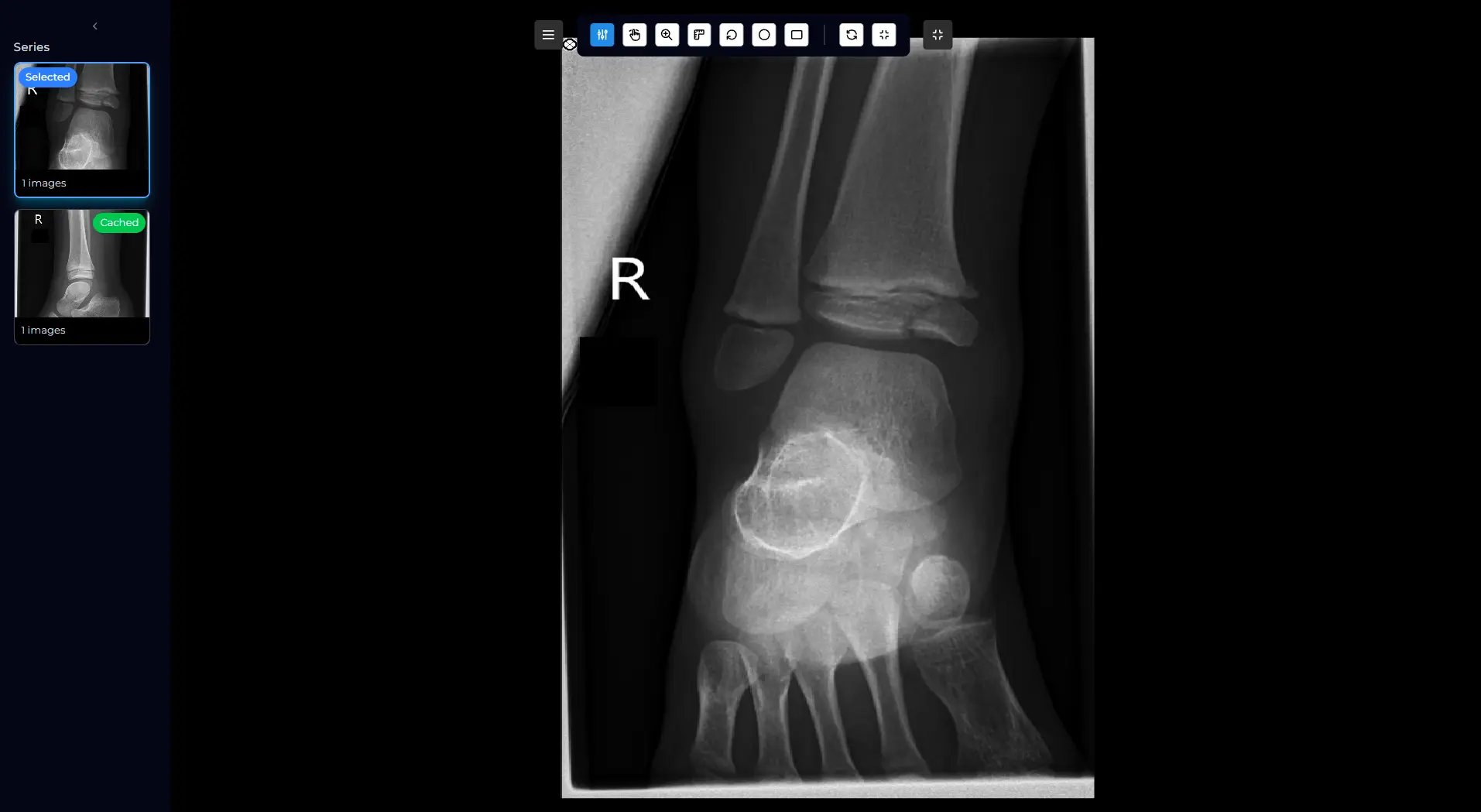MyFRCR DICOM viewer displaying full lossless medical images at diagnostic workstation quality