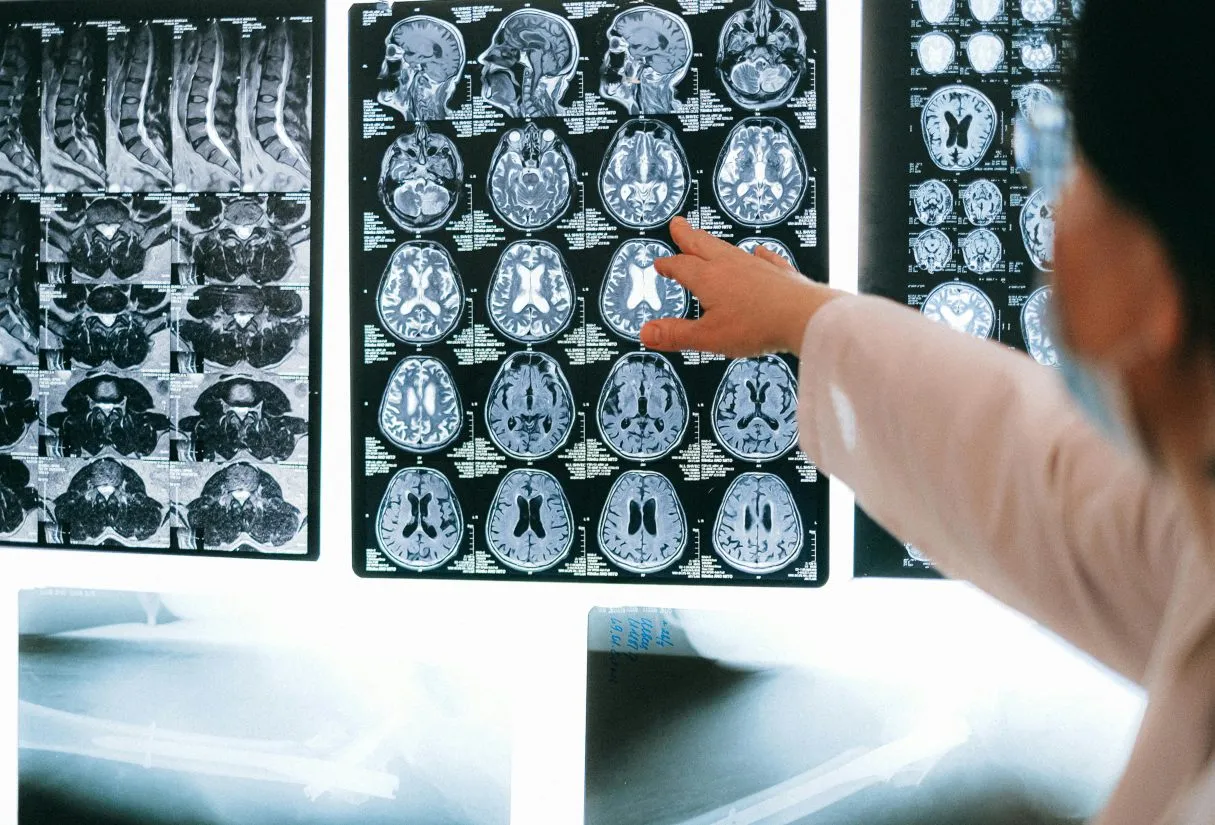 MyFRCR platform showing full lossless DICOM images for FRCR 2B exam practice